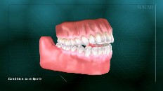 side view of a set of teeth