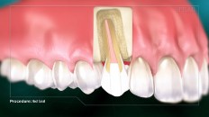 a tooth with a healthy root