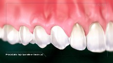 a top row of clean, healthy teeth