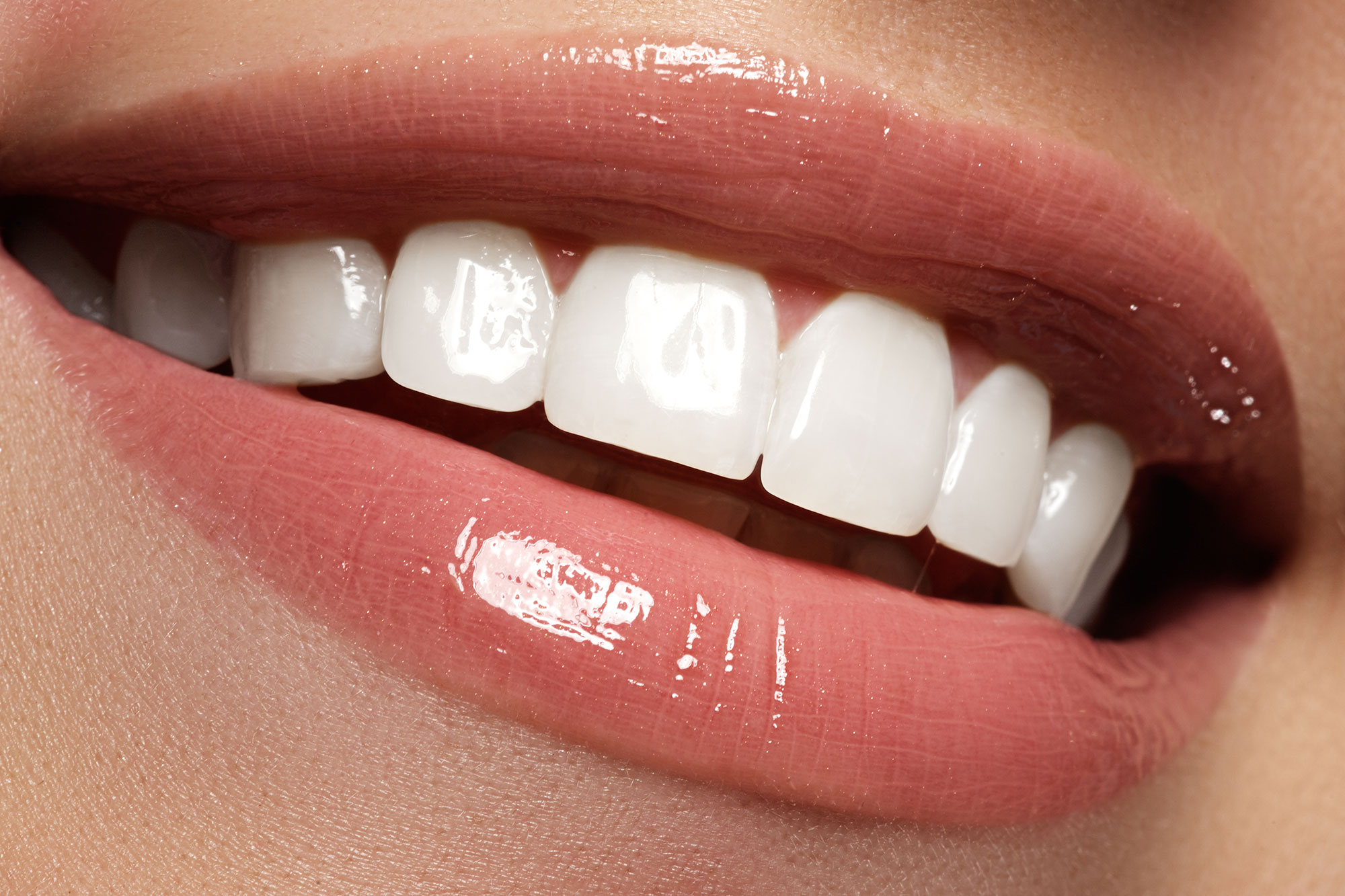 Close up image of smiling mouth with perfect straight white teeth and sparkly lipgloss